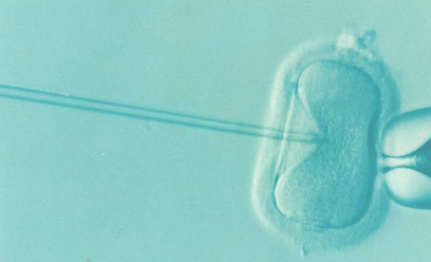 Selon une spécialiste de la reproduction, il y a « de nouvelles causes d’infertilité »